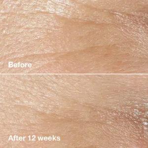 کرم دور چشم کلینیک ضد چروک ترمیم و آبرسانی و تغذیه کننده 15میل Clinique Smart Clinical Repair