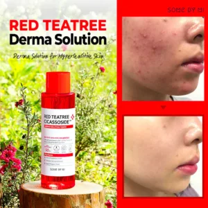 تونر درخت چای قرمز سام بای می لایه بردار با pH پایین پوست حساس و مستعد آکنه(کد0879) Teatree Cicassoside Derma