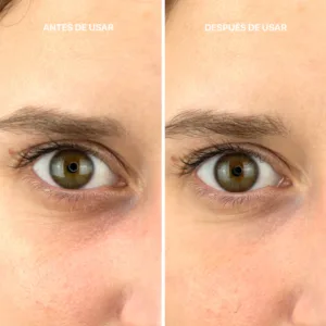 کرم دور چشم ژلی بوتولینوم لاکابین صاف کننده چروک عمیق با فیتوتنسور EYE GEL CREAM Botulinum effect کد6226
