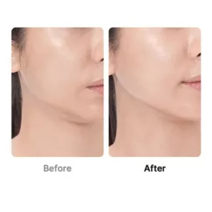 بوستر پرو مدیکیوب AGE-R Booster Pro