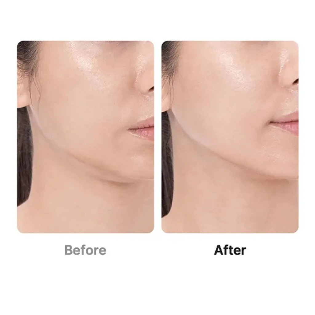 بوستر پرو مدیکیوب AGE-R Booster Pro
