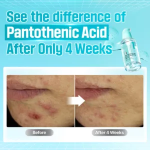 سرم آبرسان و نرم کننده پوست نامبوزین حاوی PANTOTHENIC B5