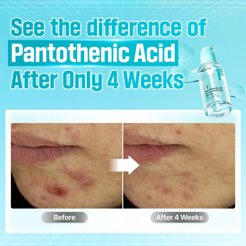 سرم آبرسان و نرم کننده پوست نامبوزین حاوی PANTOTHENIC B5