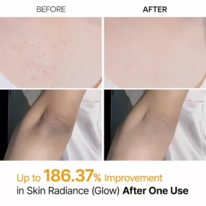 اسپری کوجیک اسید دکتر ملاکسین روشن کننده نواحی تیره بدن