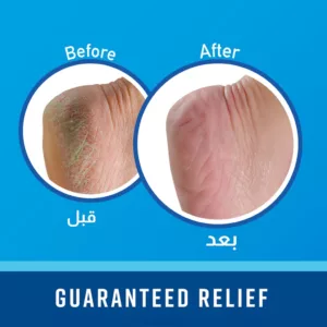 کرم پا ضد ترک و خشکی اوکیفز مدل relife