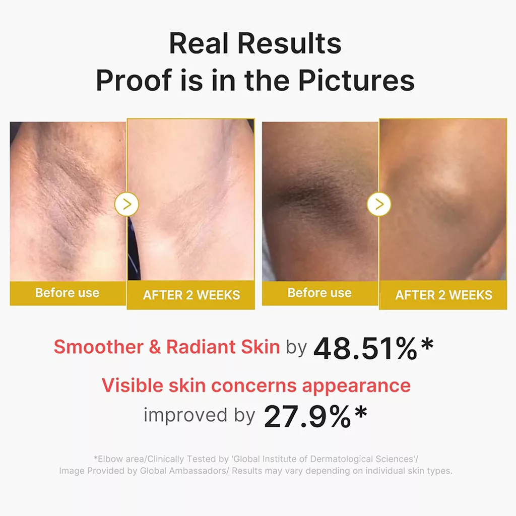 پیل شات بدن کوجیک اسید ترمریک مدی کیوب body peel shot medicube