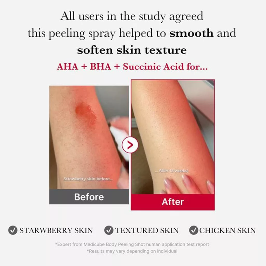 اسپری لایه بردار ضد جوش بدن مدی کیوب پیل شات RED ACNE BODY PEEL SHOT