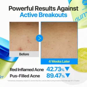 پد آزلائیک دو طرفه ضد جوش نامبوزین Numbuzin ZERO BLEMISH Azela Cica BHA+PHA Azelaic Acid