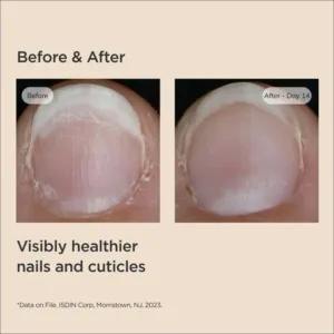 سرم تقویت ناخن ایزدین Isdin Si-Nails بدون عطر و رنگ